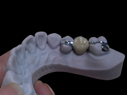 kupować Dokładny biały długotrwały Maryland Bridge Dental Dostosowywalny Do Restauracji produkcja online