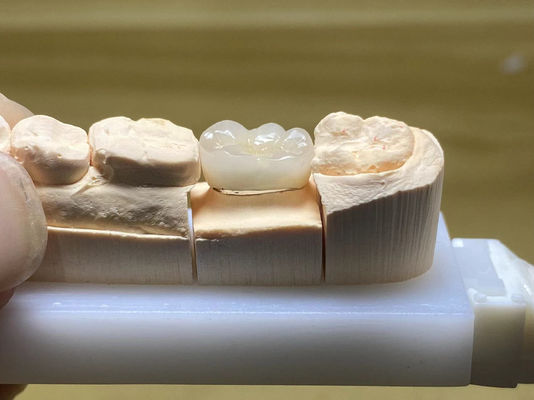 kupować Odporność na plamy PFM Ceramic korona regulowana w naturalnym kształcie zęba produkcja online