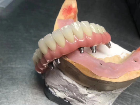 kupować Wysokiej przejrzystości Implant Solid Supported Crown Customizable For Dental Restoration produkcja online