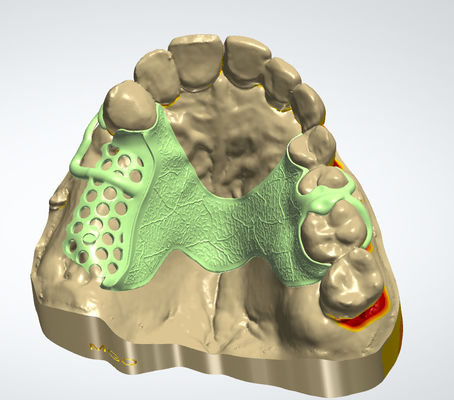 kupować Cyfrowa ramka metalowa CAD CAM Projekt stomatologiczny Materiał Cocr z drukiem 3D produkcja online
