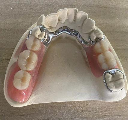 kupować Niezawodna srebrna ramka metalowa proteza odporna na korozję z dostosowalną konstrukcją produkcja online