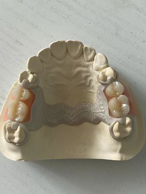 kupować Specjalistyczna dentystyczna proteza akrylowa, regulowana z bezpiecznym dopasowaniem produkcja online