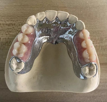 Wysoko wytrzymałe odlewy metalowe z częściową protezą Cocr Aolly z drukiem 3D