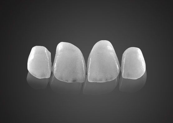 IPS 0.2mm Ultra Thin Emax Veneers Odporny na plamy z wysoką wytrzymałością