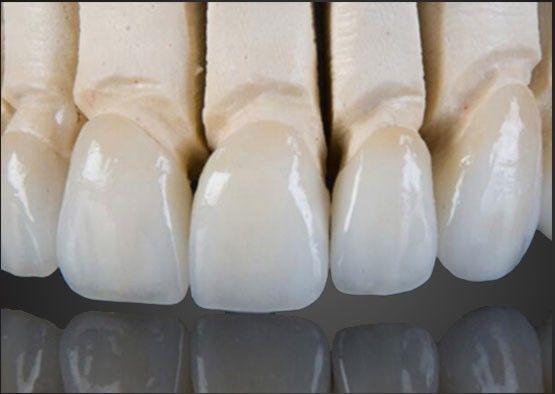 Wieland Zirconia All Ceramic Crown Wnętrze malowane na zamówienie