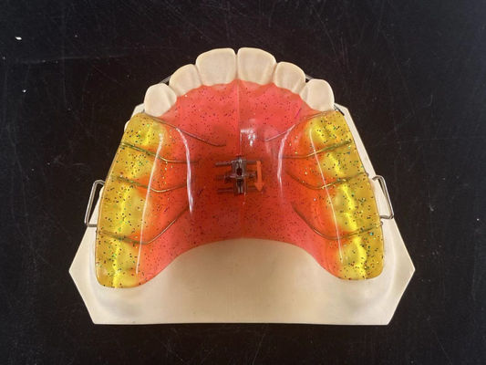 Dostosowany 2 Ways Dental Arch Expander Regulowalne urządzenie ortodontyczne